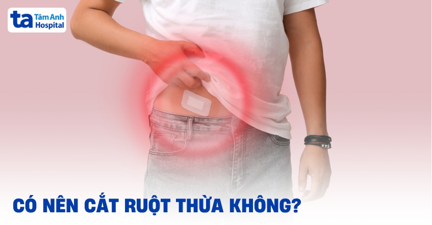 Có nên cắt ruột thừa không? Khi nào nên cắt bỏ và vì sao?