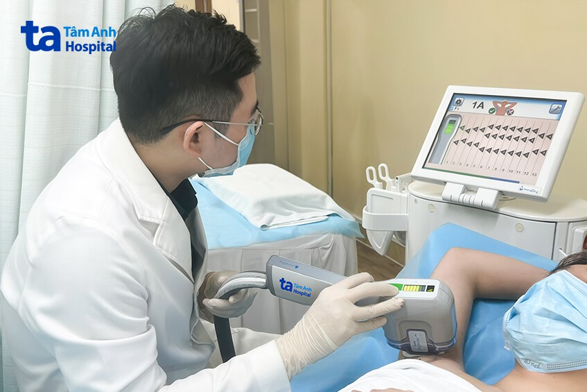 công nghệ vi sóng điều trị chứng tăng tiết mồ hôi