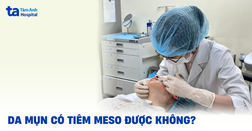 Da mụn có tiêm meso được không? Tiêm rồi có gây ảnh hưởng gì?