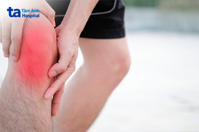 Đau khớp gối do chơi thể thao là gì?