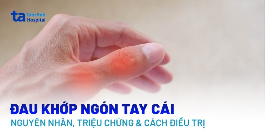 Đau khớp ngón tay cái phải làm sao? Cách cải thiện và điều trị