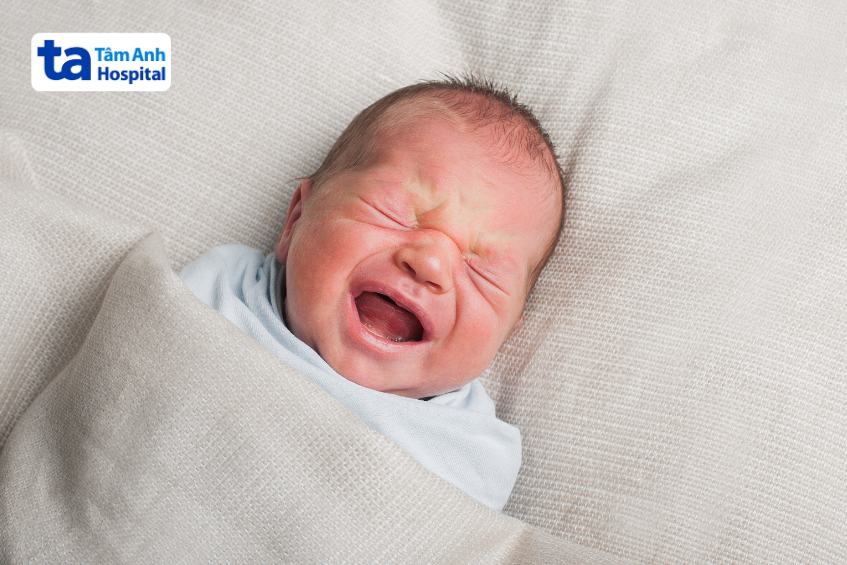 dị tật hậu môn trực tràng khiến trẻ sơ sinh dễ bị tắc ruột