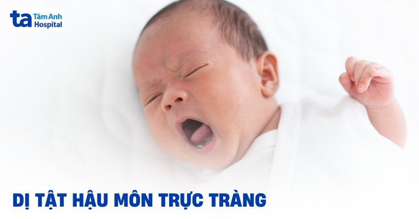 Dị tật hậu môn trực tràng ở trẻ sơ sinh: Chẩn đoán và điều trị