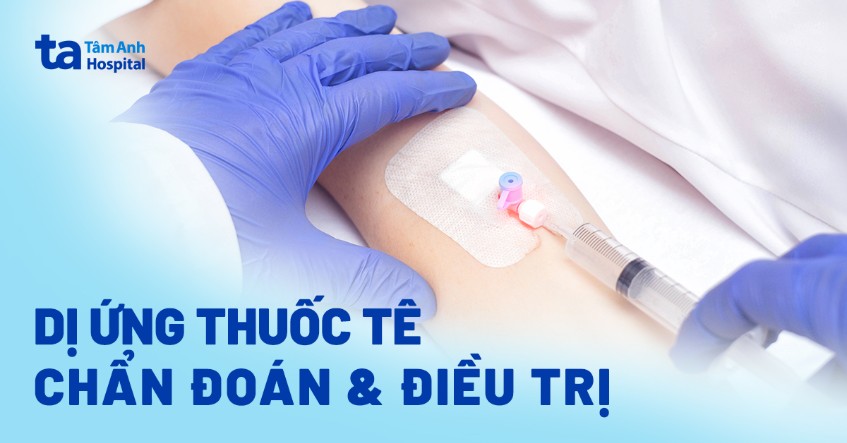 Dị ứng thuốc tê: Nguyên nhân, biểu hiện, chẩn đoán và điều trị