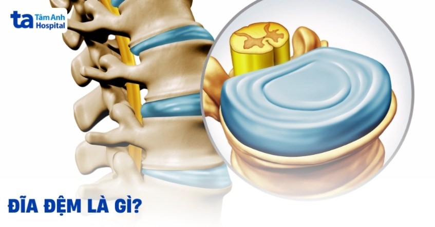 Đĩa đệm là gì? Đặc điểm, vị trí, cấu tạo và chức năng