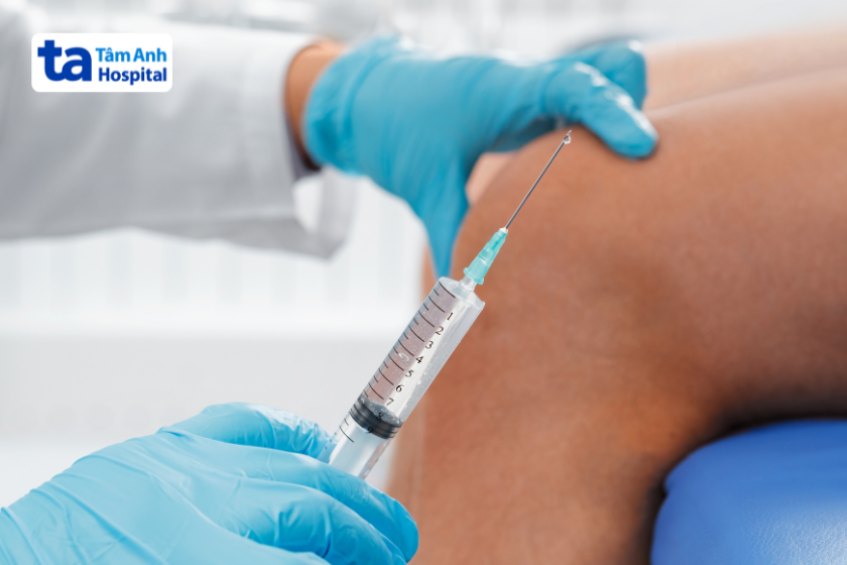 Điều trị chấn thương đầu gối khi đá bóng