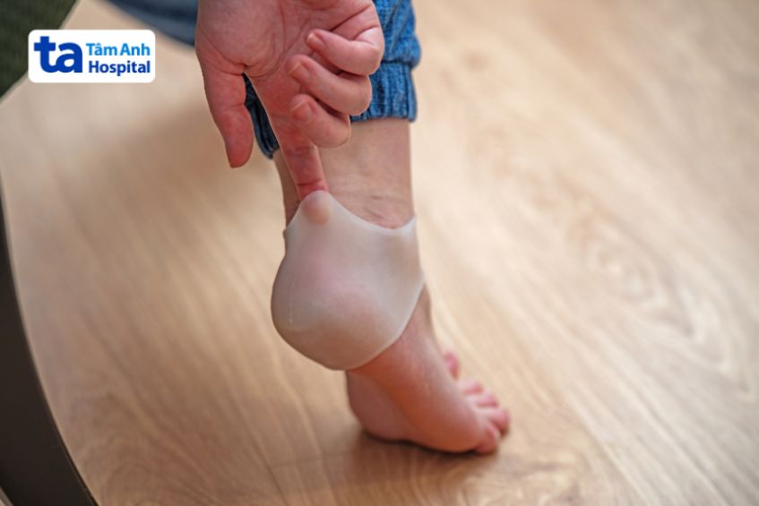 Điều trị chấn thương gân Achilles