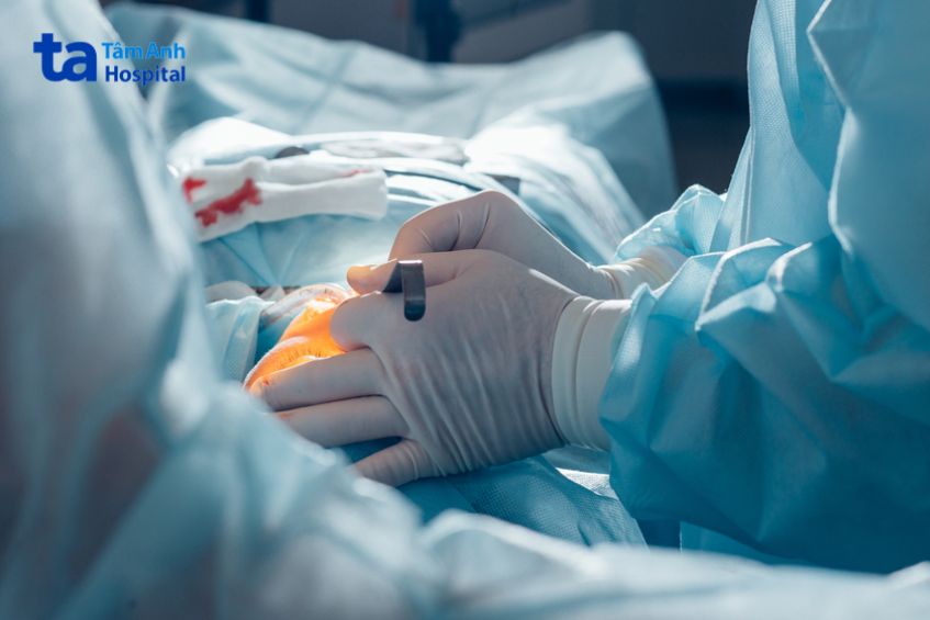 Điều trị phì đại tuyến vú ở nam giới