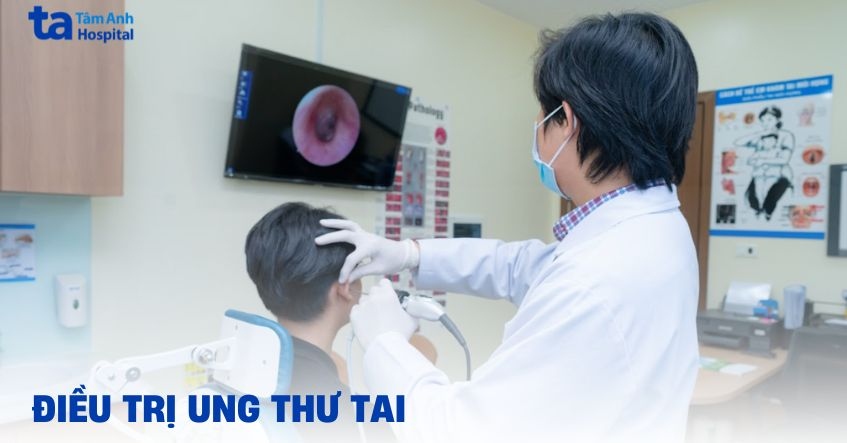 6 phương pháp điều trị ung thư tai, lưu ý khi chữa bệnh
