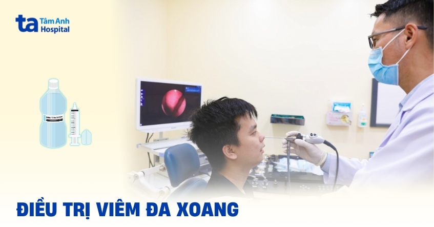 3 phương pháp điều trị viêm đa xoang, có chữa được không?