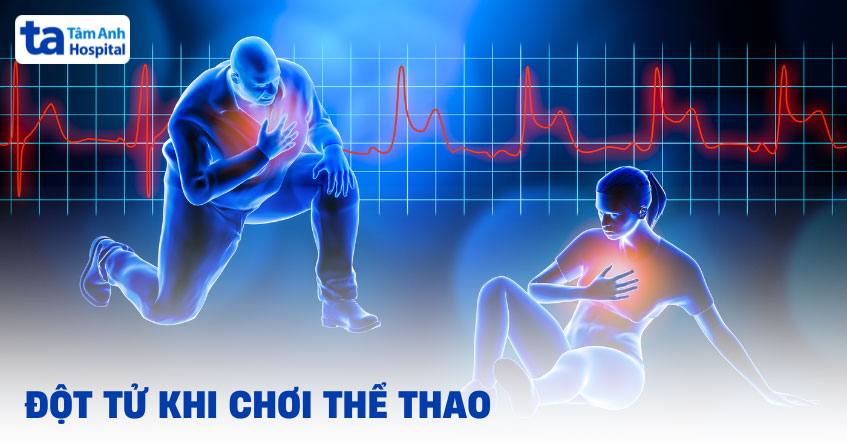 Đột tử khi chơi thể thao: Nguyên nhân, dấu hiệu và cách xử trí