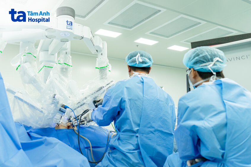 các cánh tay robot