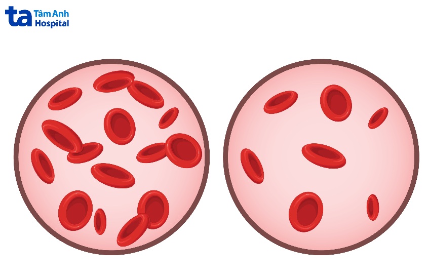 giảm hồng cầu tác dụng phụ của hóa trị