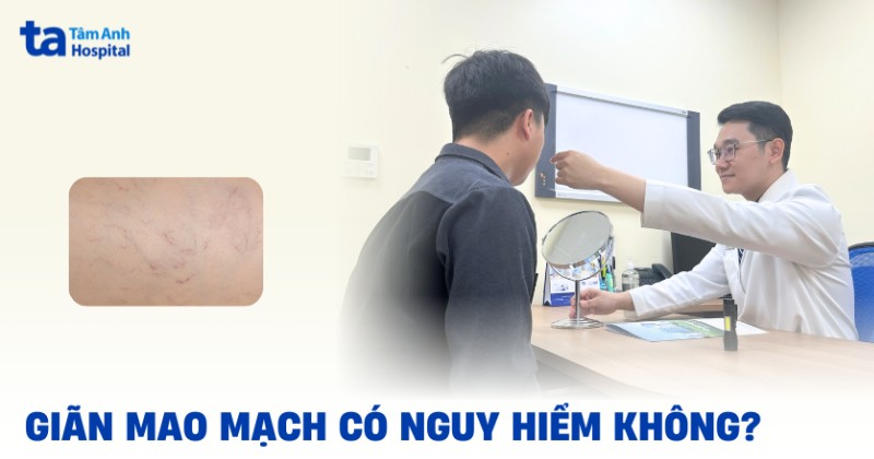 Bệnh giãn mao mạch có nguy hiểm không? Cách khắc phục