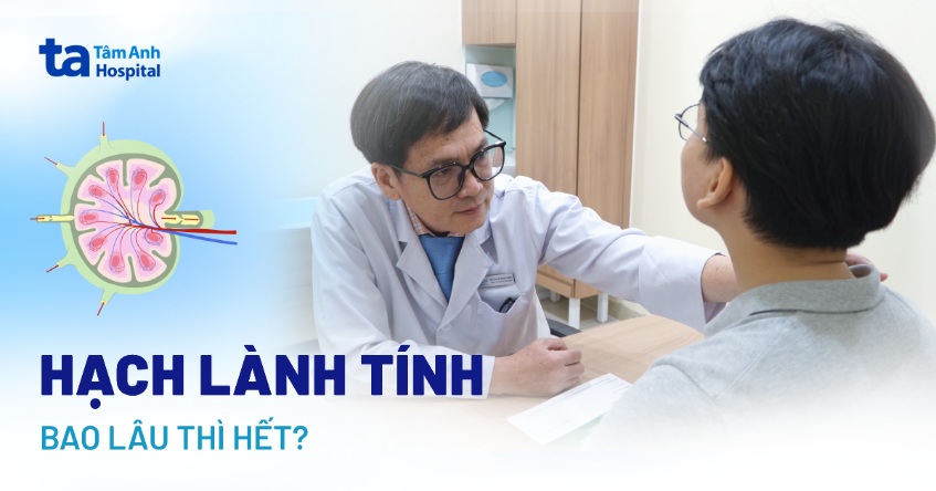 Hạch lành tính bao lâu thì hết? Khi nào cần đến bệnh viện khám?