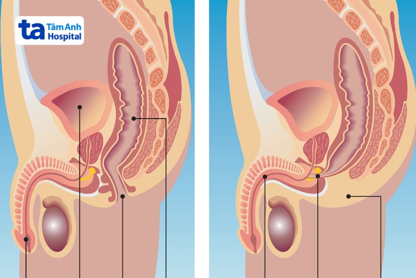 hậu môn trực tràng bị dị tật ở bé trai