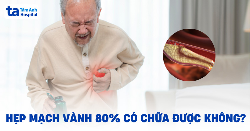 Hẹp mạch vành 80% có nguy hiểm không? Có chữa được không?