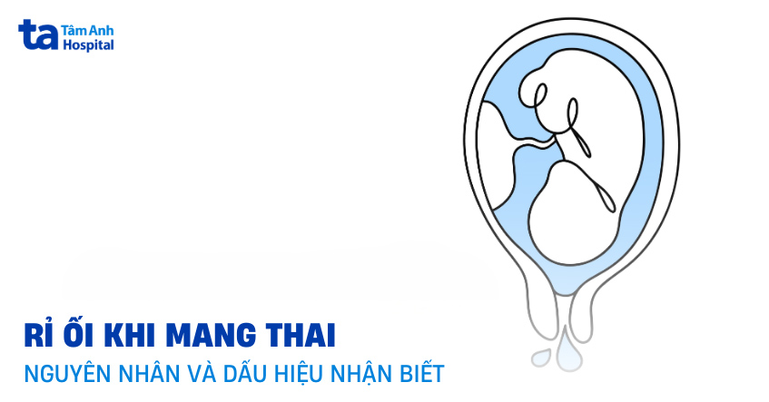 hiện tượng rỉ ối
