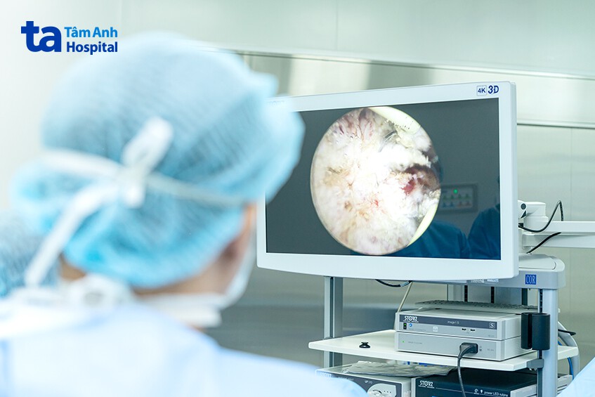 hình ảnh khối u