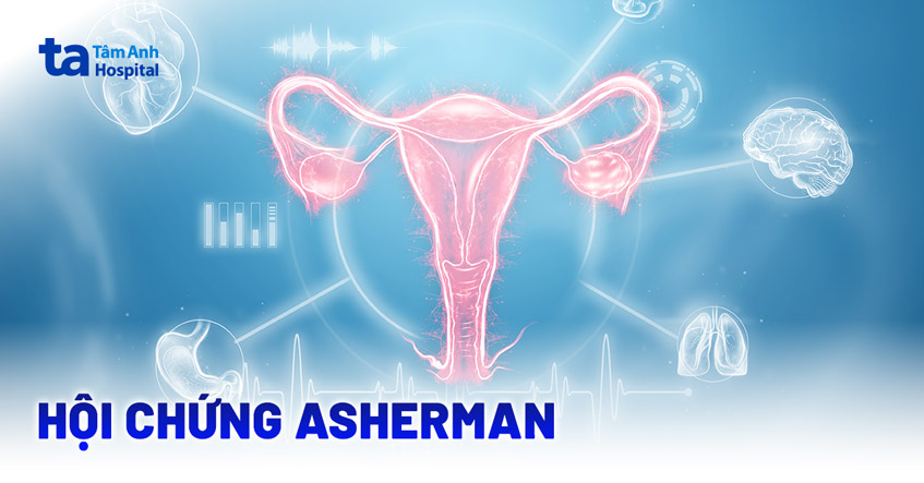 Hội chứng Asherman: Nguyên nhân, dấu hiệu, chẩn đoán, điều trị