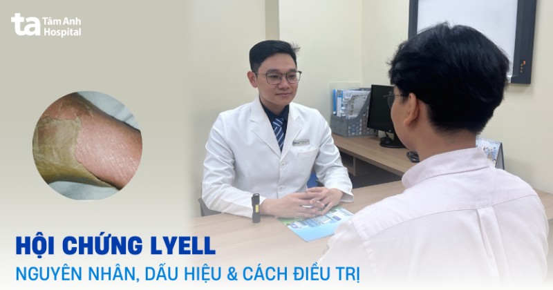 Hội chứng Lyell: Nguyên nhân, dấu hiệu điển hình và điều trị