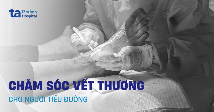 Hướng dẫn chăm sóc vết thương cho người tiểu đường mau lành
