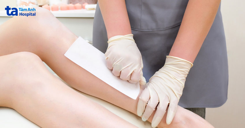 kem tẩy lông có thể gây kích ứng da