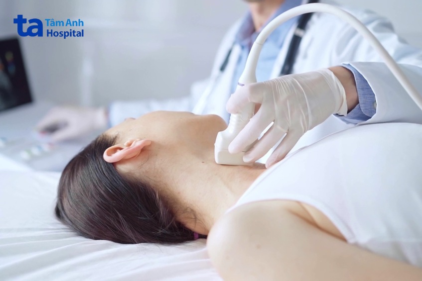 khi nào cần dùng thuốc điều trị bướu cổ