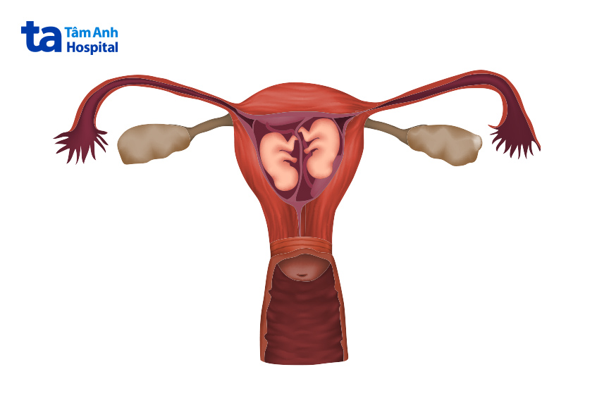 Không phải trường hợp thai đôi IVF nào cũng chỉ định khâu cổ tử cung