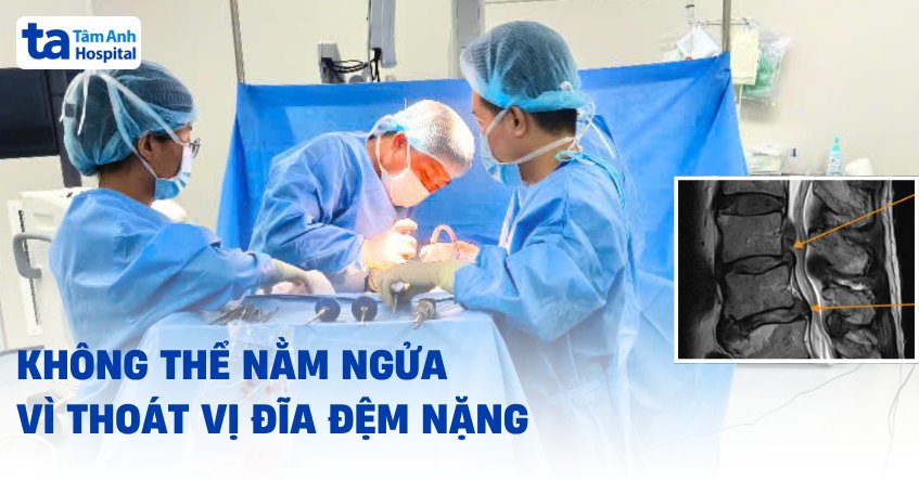 không thể nằm ngửa vì thoát vị đĩa đệm nặng