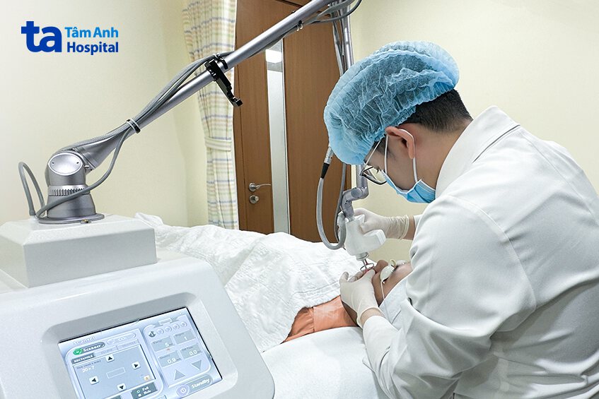 laser co2 điều trị sẹo