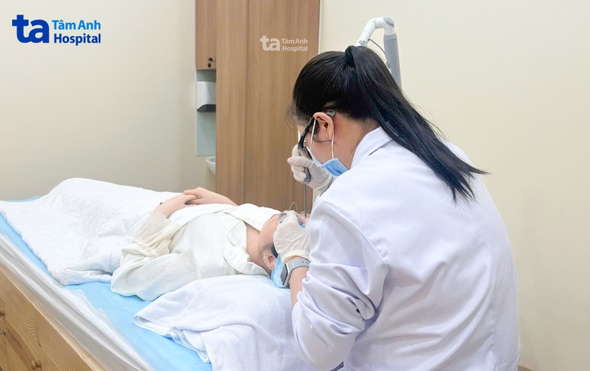 laser điều trị thâm sẹo mụn