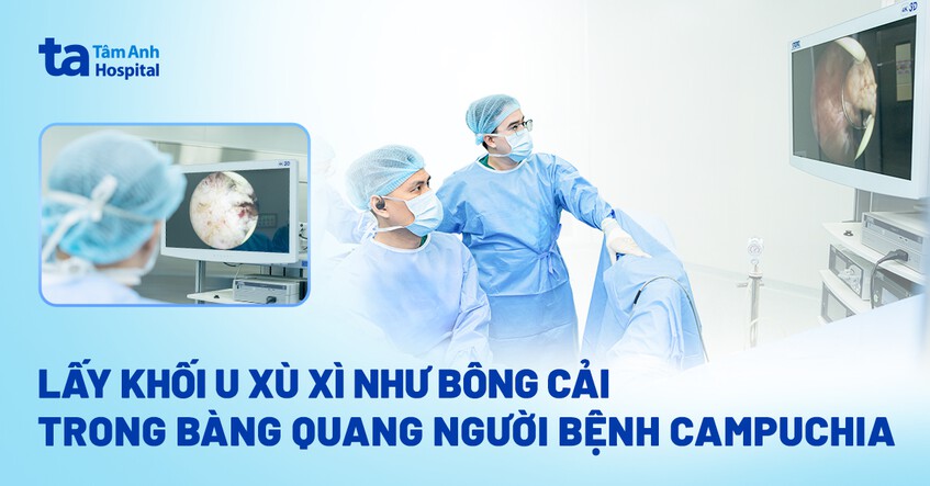 lấy khối u trong người bệnh campuchia