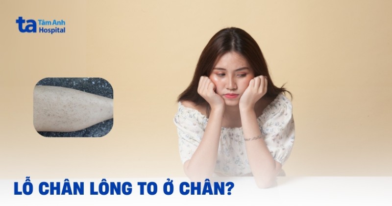 Lỗ chân lông to ở chân: Hình ảnh, nguyên nhân và điều trị
