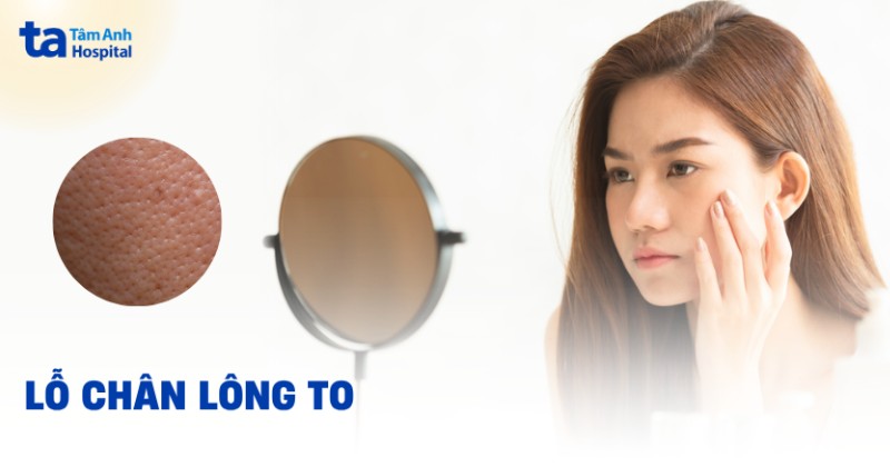 Tại sao lỗ chân lông to? Hình ảnh và cách phòng ngừa
