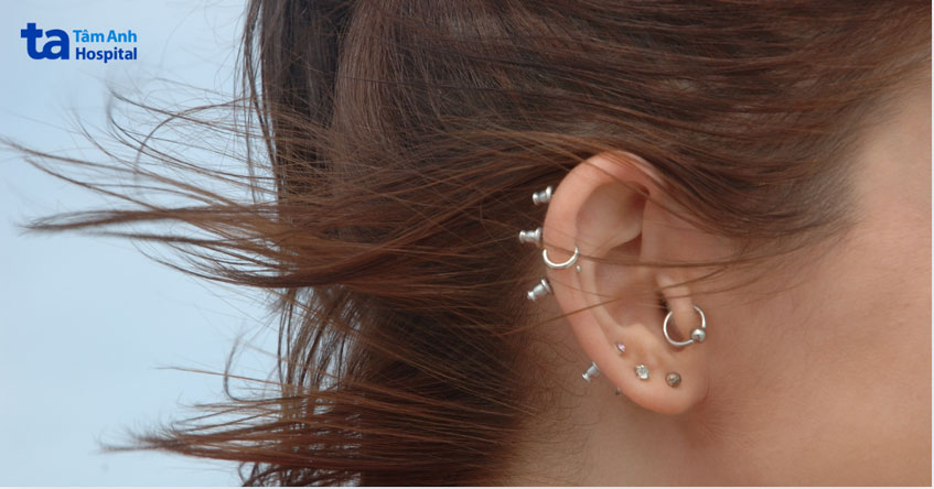 lỗ xỏ khuyên không vệ sinh kỹ sẽ phát triển nhọt