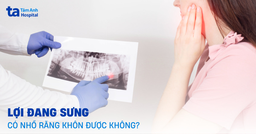 Lợi đang sưng có nhổ răng khôn được không và có nguy hiểm?
