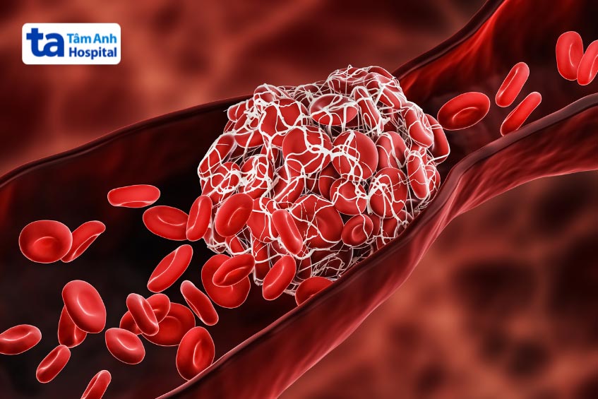 mau-dong-lam-tac-nghen-mach