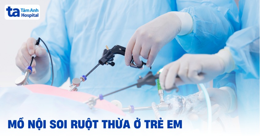 Mổ nội soi ruột thừa ở trẻ em: Hình ảnh và quy trình phẫu thuật