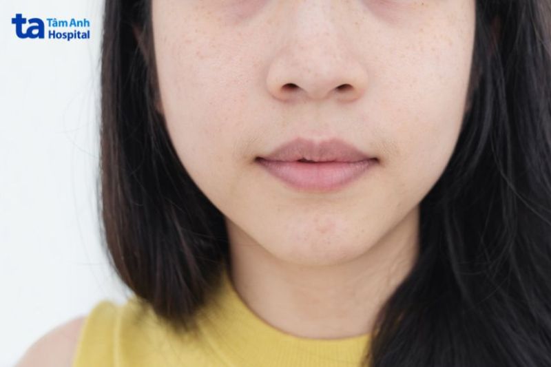 môi đang có dấu hiệu thâm vừa chuyển sang tím