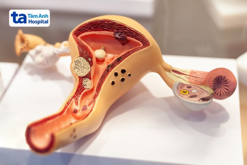 môi trường tử cung không thuận lợi