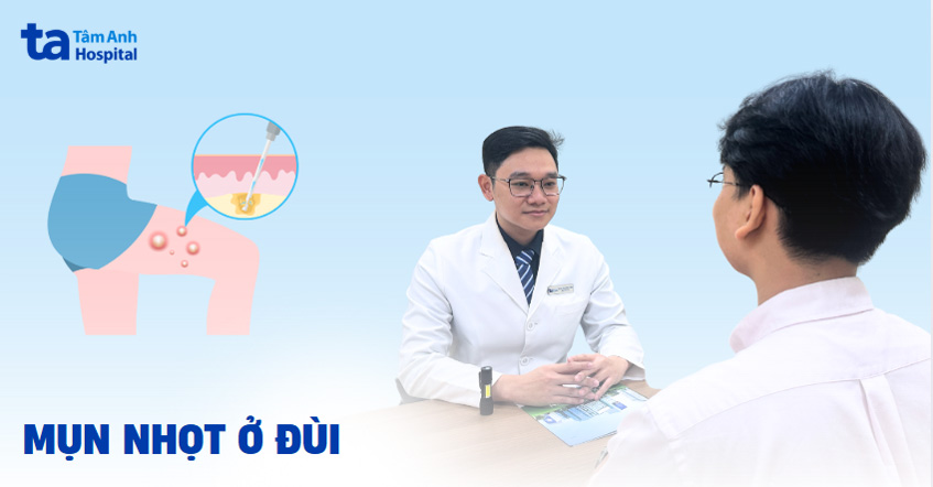 mụn nhọt ở đùi