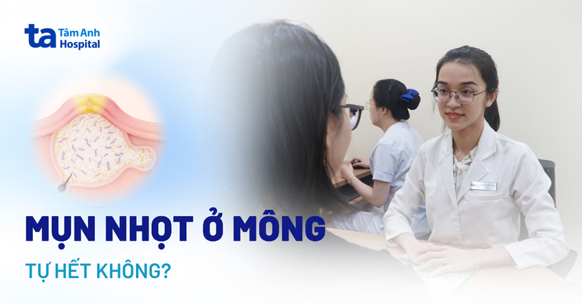 mụn nhọt ở mông có tự hết không