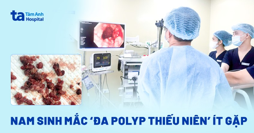 nam sinh mắc đa polyp