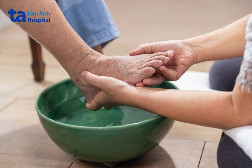 Người bệnh đái tháo đường cần vệ sinh chân hàng ngày