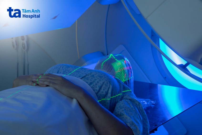 người bệnh ung thư vòm họng xạ trị