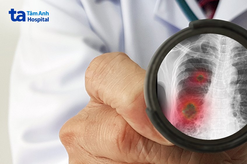 người bệnh và gia đình chủ động có biện pháp phòng tránh