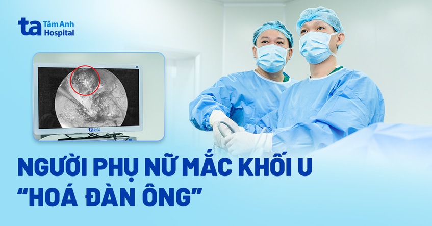 người phụ nữ mắc khối u hóa đàn ông