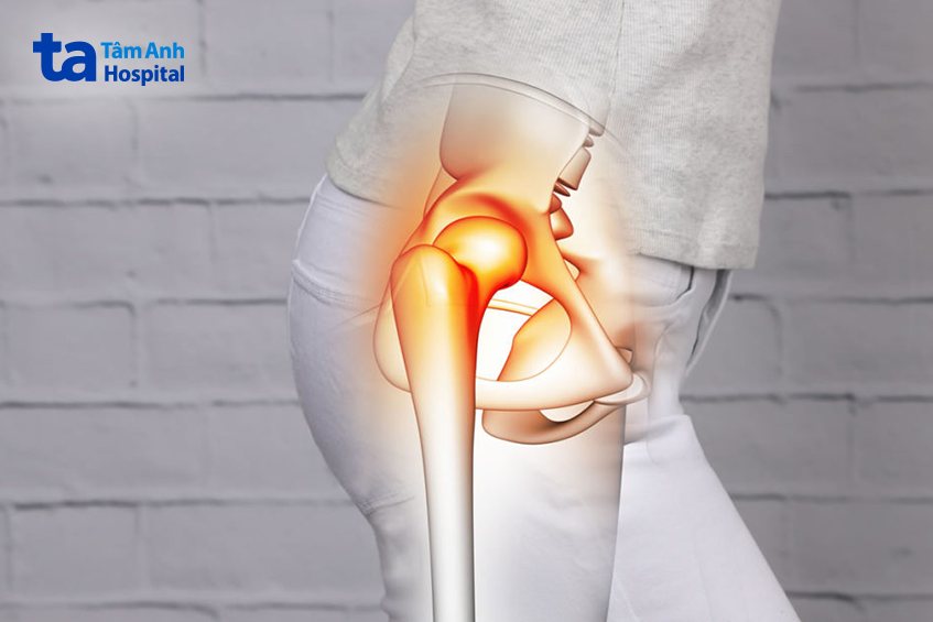 Nguyên nhân gây đau khớp háng bên phải