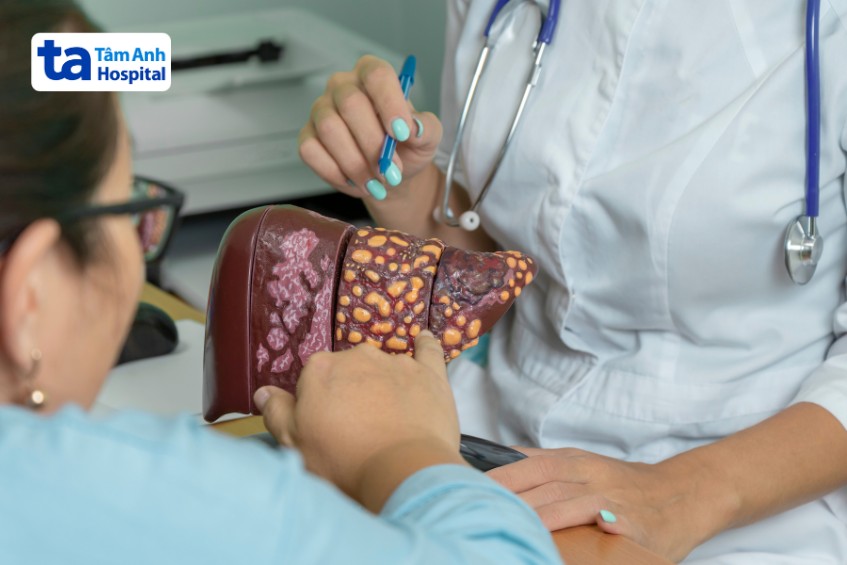 nguyên nhân vỡ tĩnh mạch thực quản